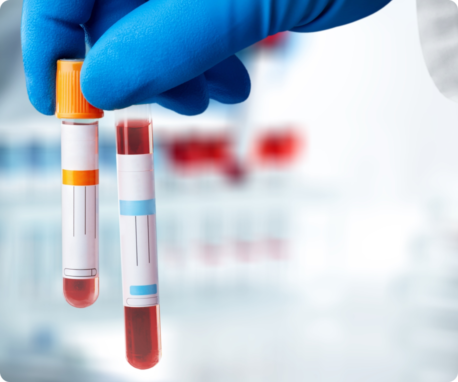 Blood test vials being held by gloved hand